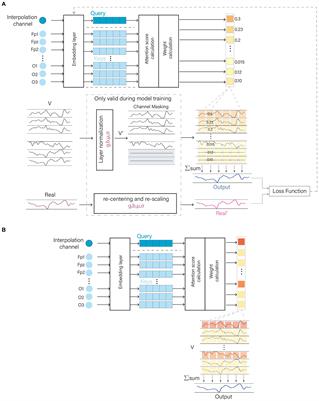 Assigning channel weights using an attention mechanism: an EEG interpolation algorithm